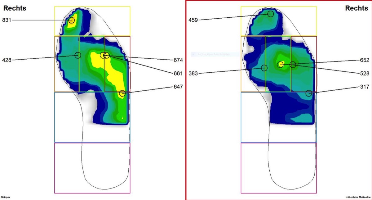 Ergebnisse Fußdruckmessung Bikefitting Berlin