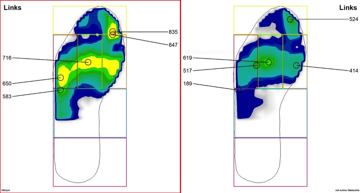 Fußdruckmessung Bikefitting Berlin